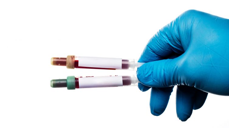 Researcher holding two blood samples